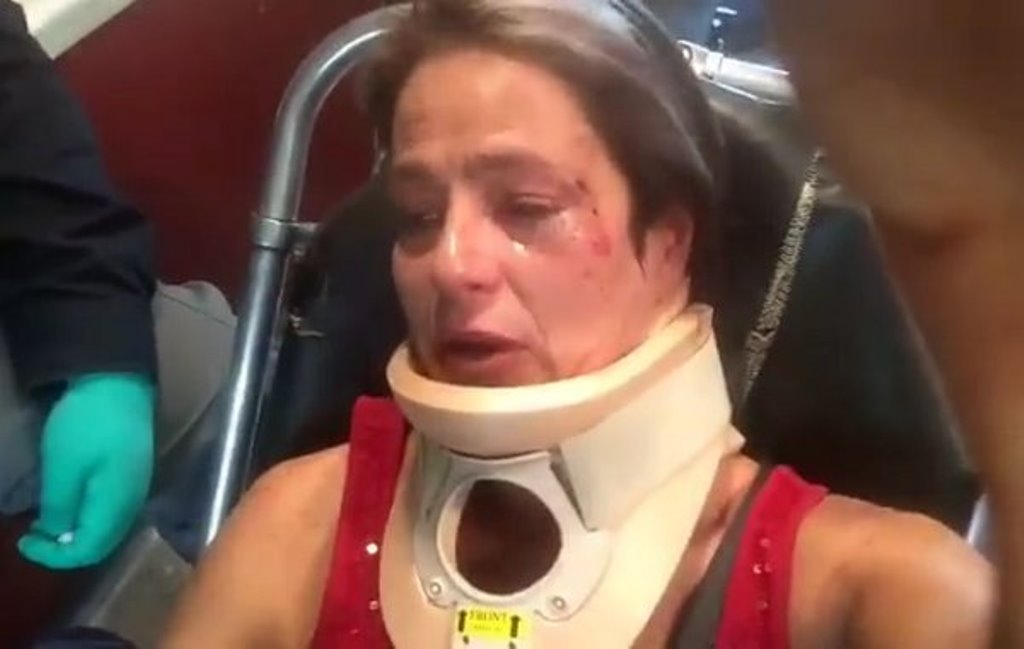 Sujeto golpea a una actriz por no querer levantar la popó de su perro