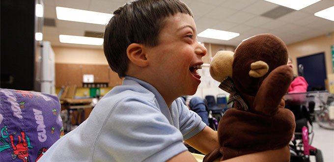 Conoce el tratamiento eficaz para el síndrome de Down