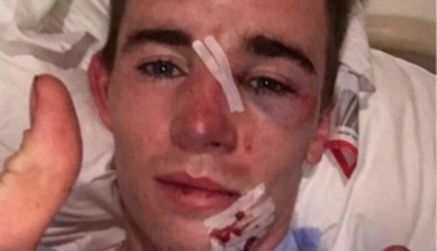Joven es atropellado por la ambulancia que iba a auxiliarlo