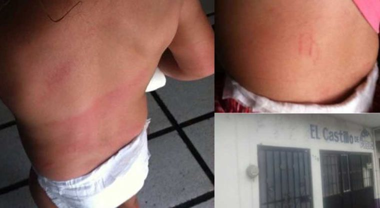Golpean fuertemente a niña de 1 año en guardería