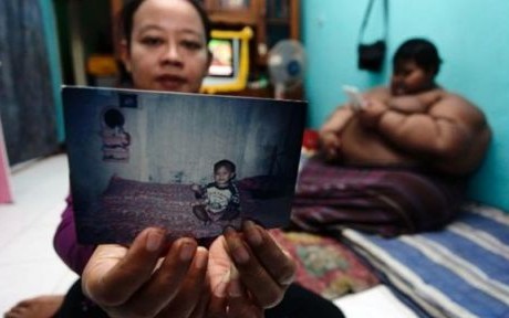 Niño de 10 años pesa 192 kilos