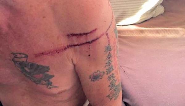 Hombre se salva de ataque de osa por ‘boxear’ contra ella