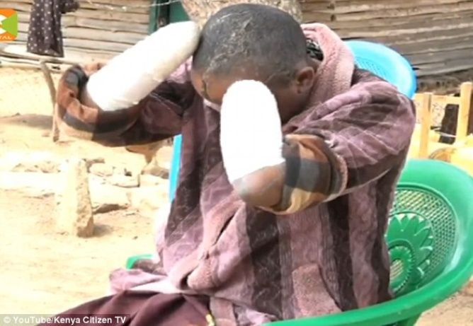 Le corta las manos a su esposa a machetazos