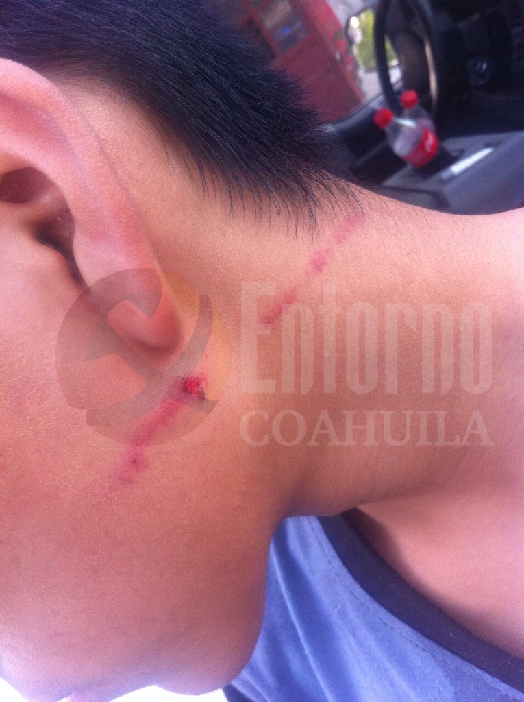 Asaltan y casi degüellan a joven en Acuña
