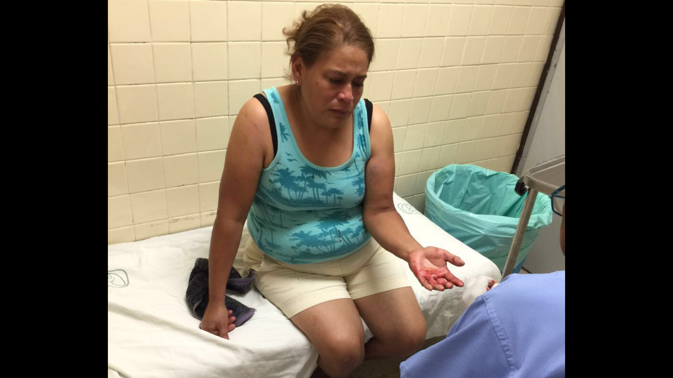 Lesiona a su esposa de un machetazo