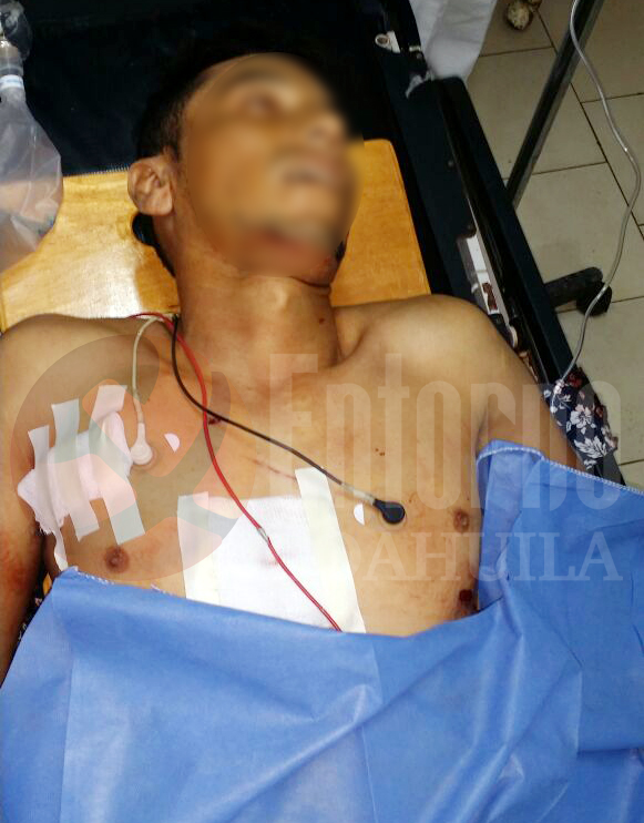 Muere de dos puñaladas en Torreón