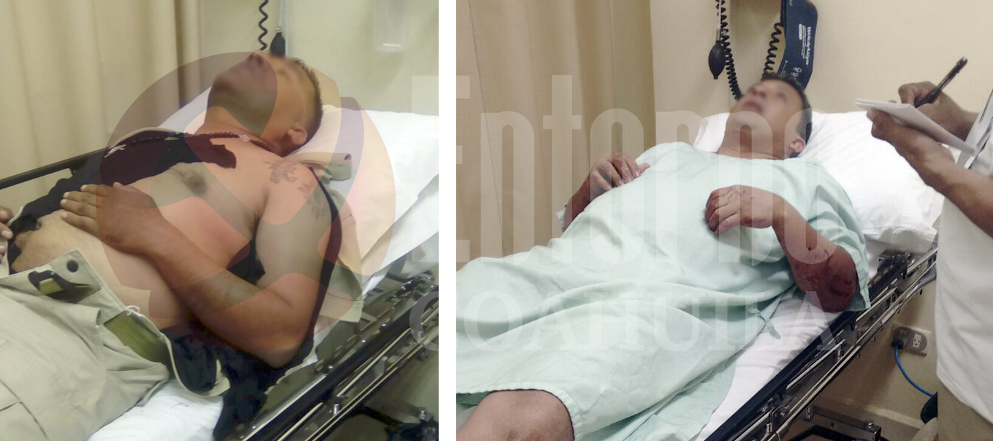 Vuelcan escoltas de Lenin Pérez