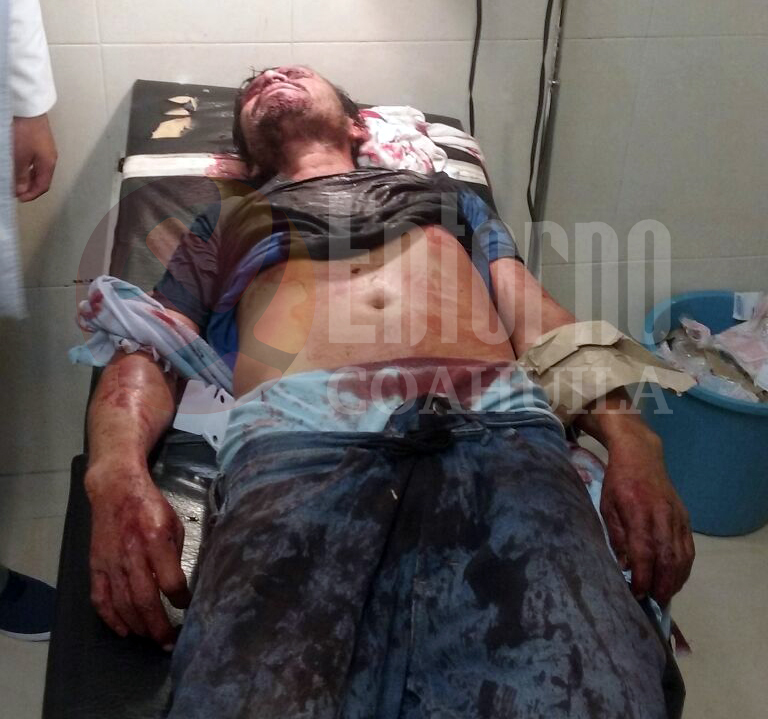 Golpean y dejan tirado a hombre en ejido de San Pedro