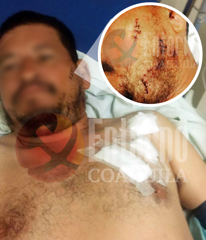 Lo bajan de auto para navajearlo