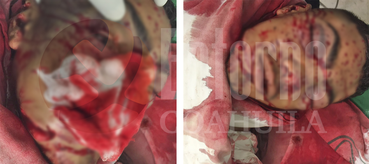 Atacan a joven a escopetazos en Piedras Negras