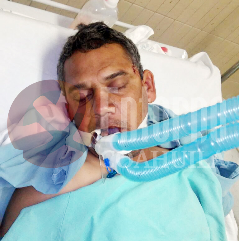 Resulta con traumatismo craneoencefálico tras accidente automovilístico
