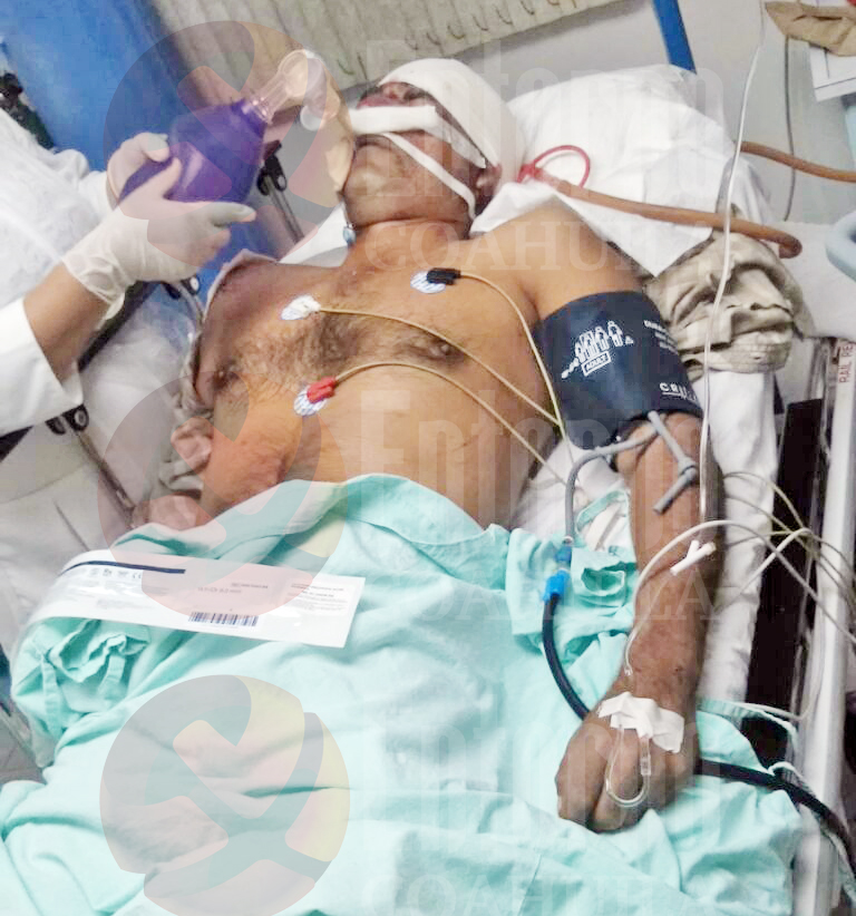 Queda grave tras caer de moto en Acuña