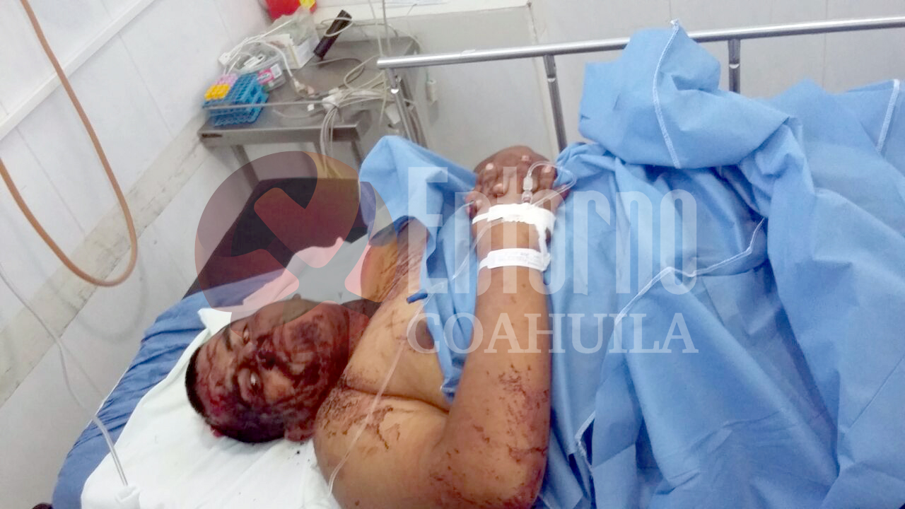 Por unas despensas mata a su hija de <br>dos años en Saltillo; hay 4 más heridos