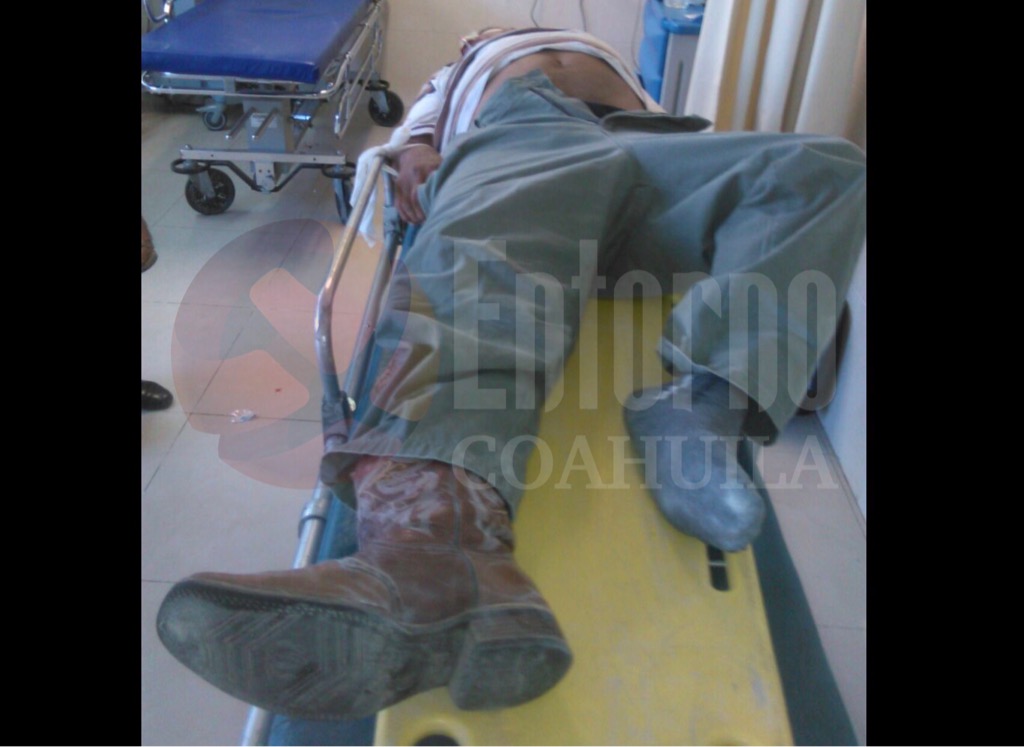 Arrolla “auto fantasma” a hombre en la San Pedro-Torreón