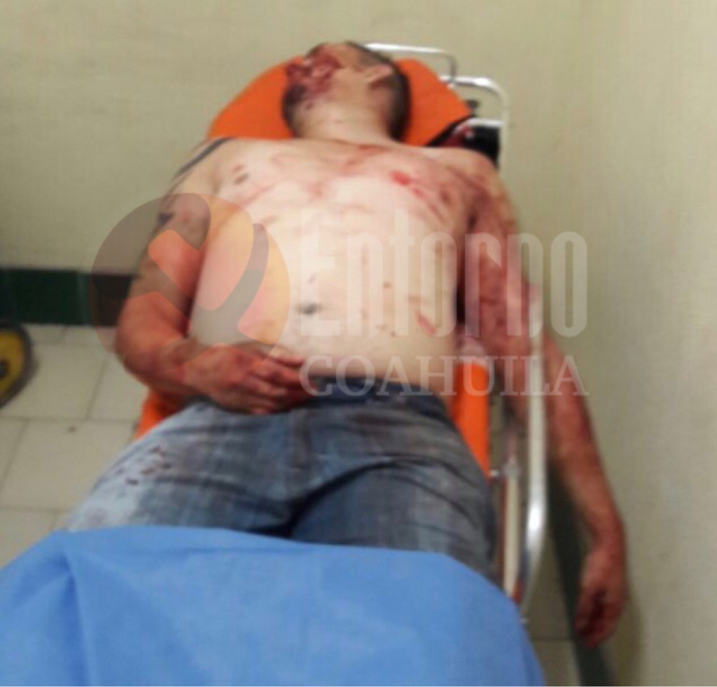 Lo matan amigos por accidente en Torreón