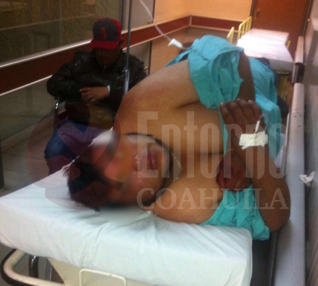 Atacan a navajazos a joven en Parras