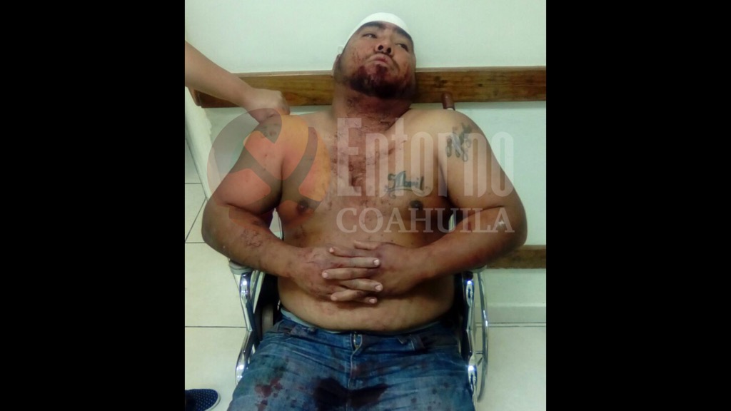 Le abren la cabeza a navajazos en Acuña