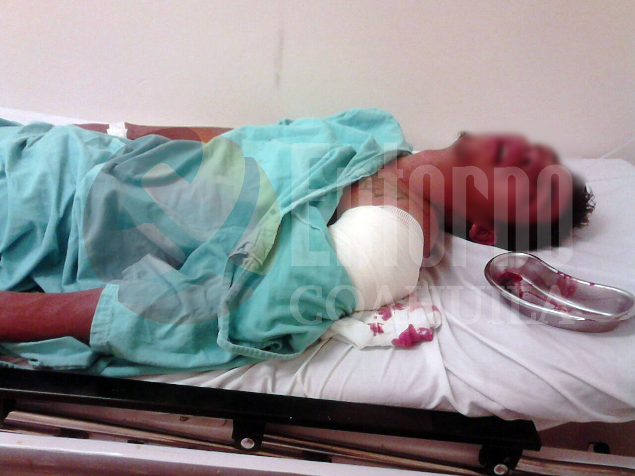 Lo balacea “El Pelón” en Parras luego de pelear