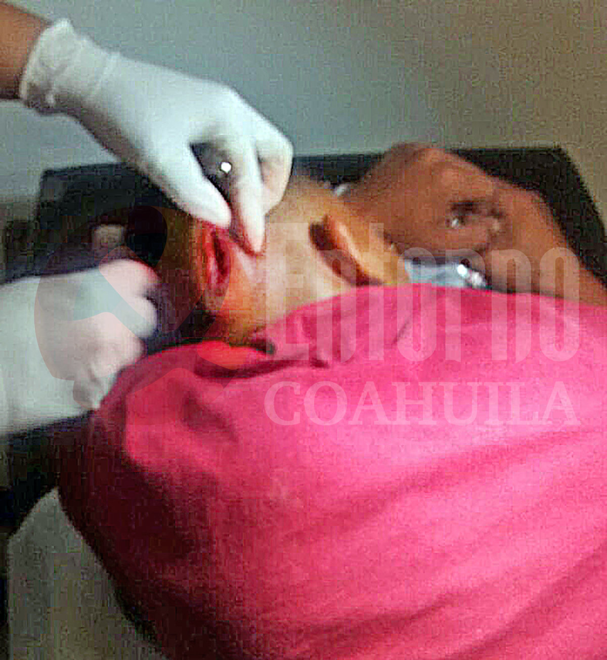 Lo agarra su primo a batazos en Sabinas