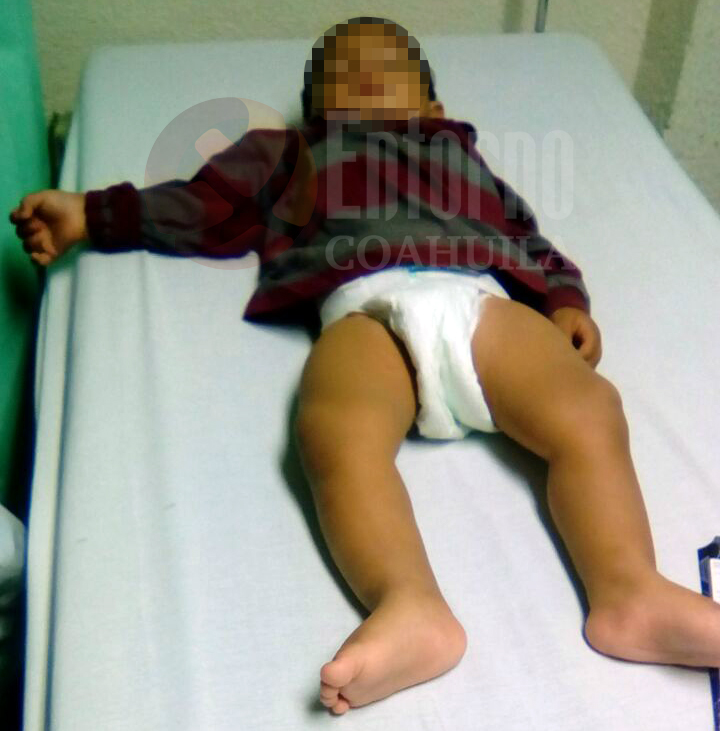 Se les cae bebé de los brazos; está grave