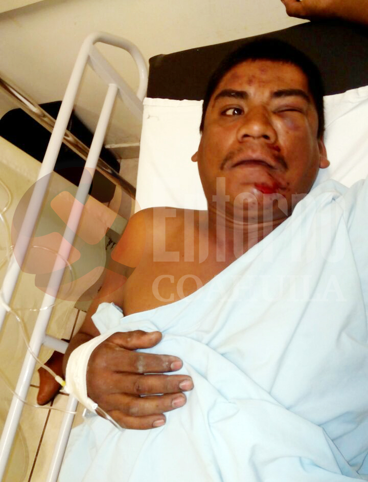 Desconocidos le dan golpiza en Palaú