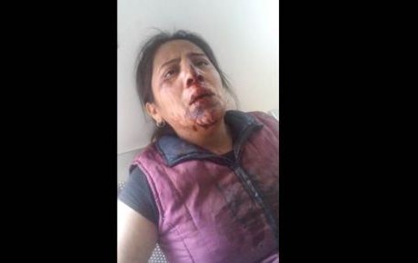 Ignoran a mujer que acudió al MP a denunciar golpiza (Video)