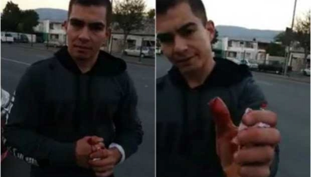 Le arrancan medio dedo a joven al intentar robar su auto
