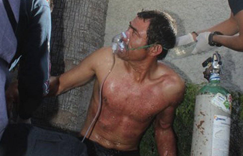 Intentó suicidarse dos veces rociándose gasolina