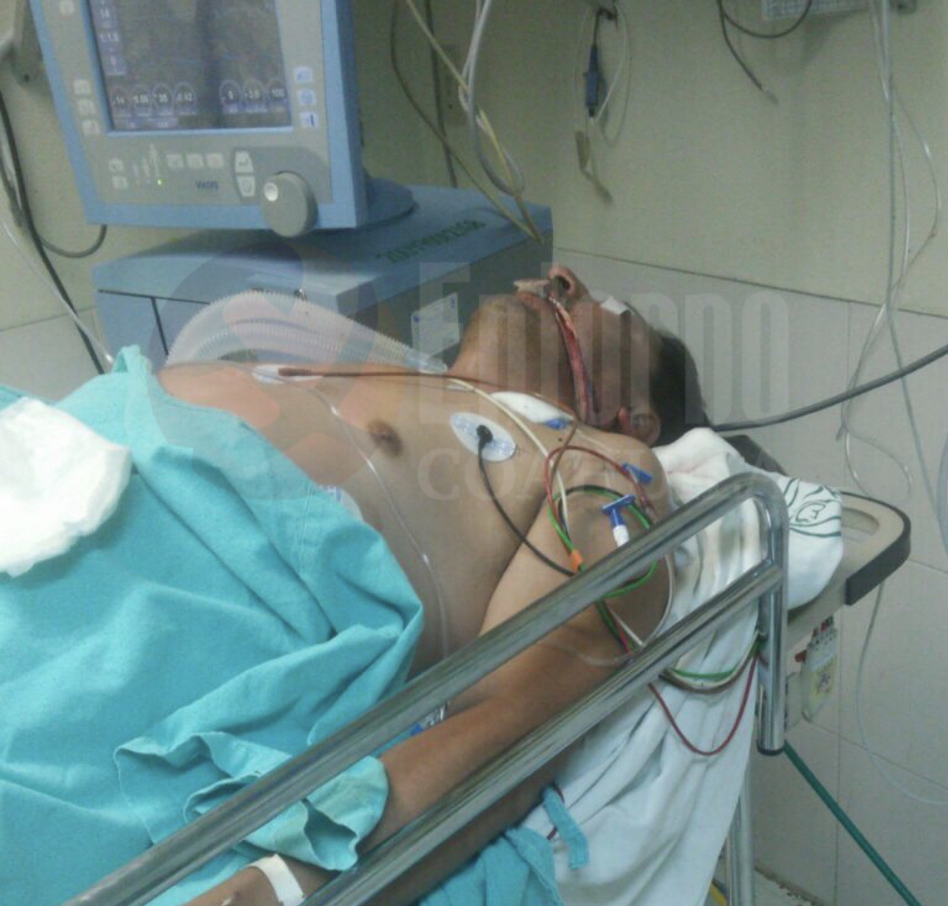 Provocan muerte cerebral a saltillense por golpiza