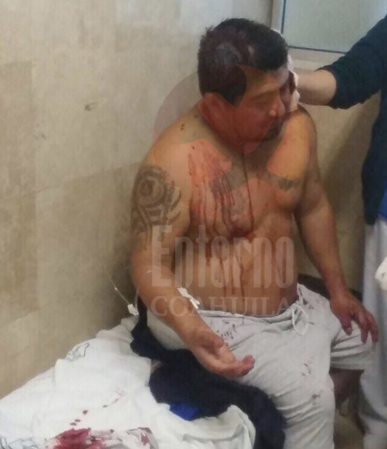 Otro acuñense mal herido en una fiesta