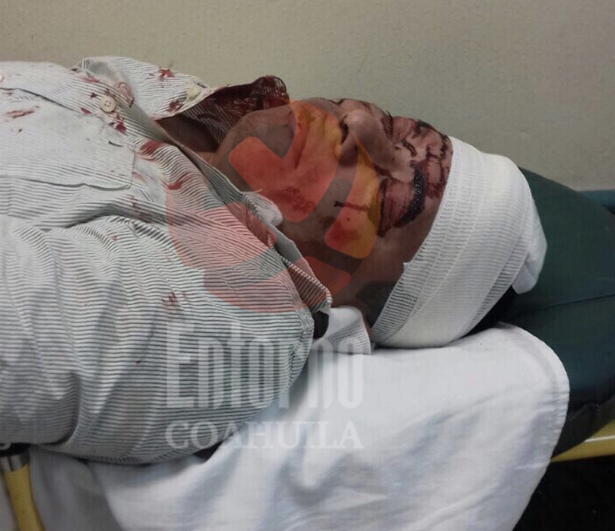 Llegan hasta a su casa e Acuña <br>y casi lo matan a batazos