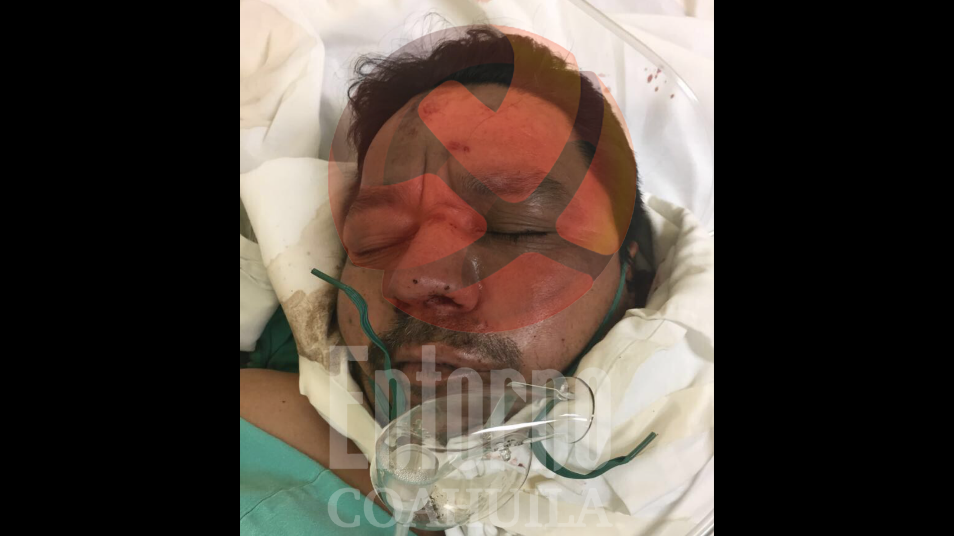 Atropella a adulto en Acuña y se da a la fuga