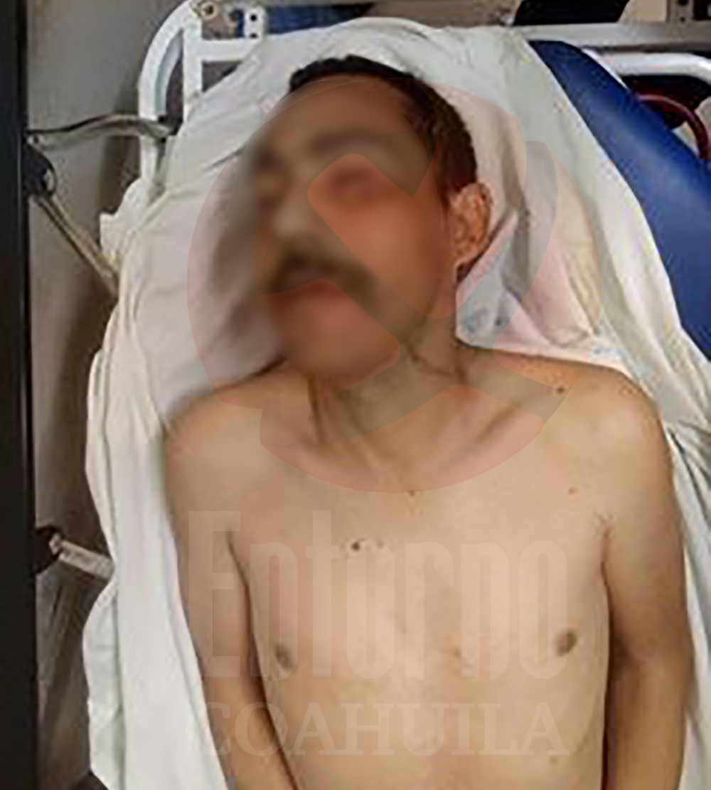 Muere por causas naturales interno del Cereso Saltillo