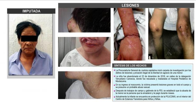 “Abuela torturadora” es vinculada a proceso