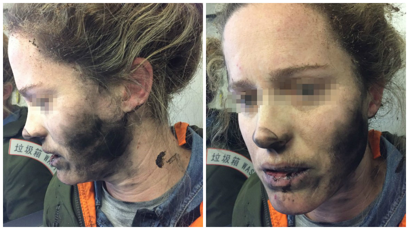Audífonos le explotan en pleno vuelo y mujer sufre quemaduras