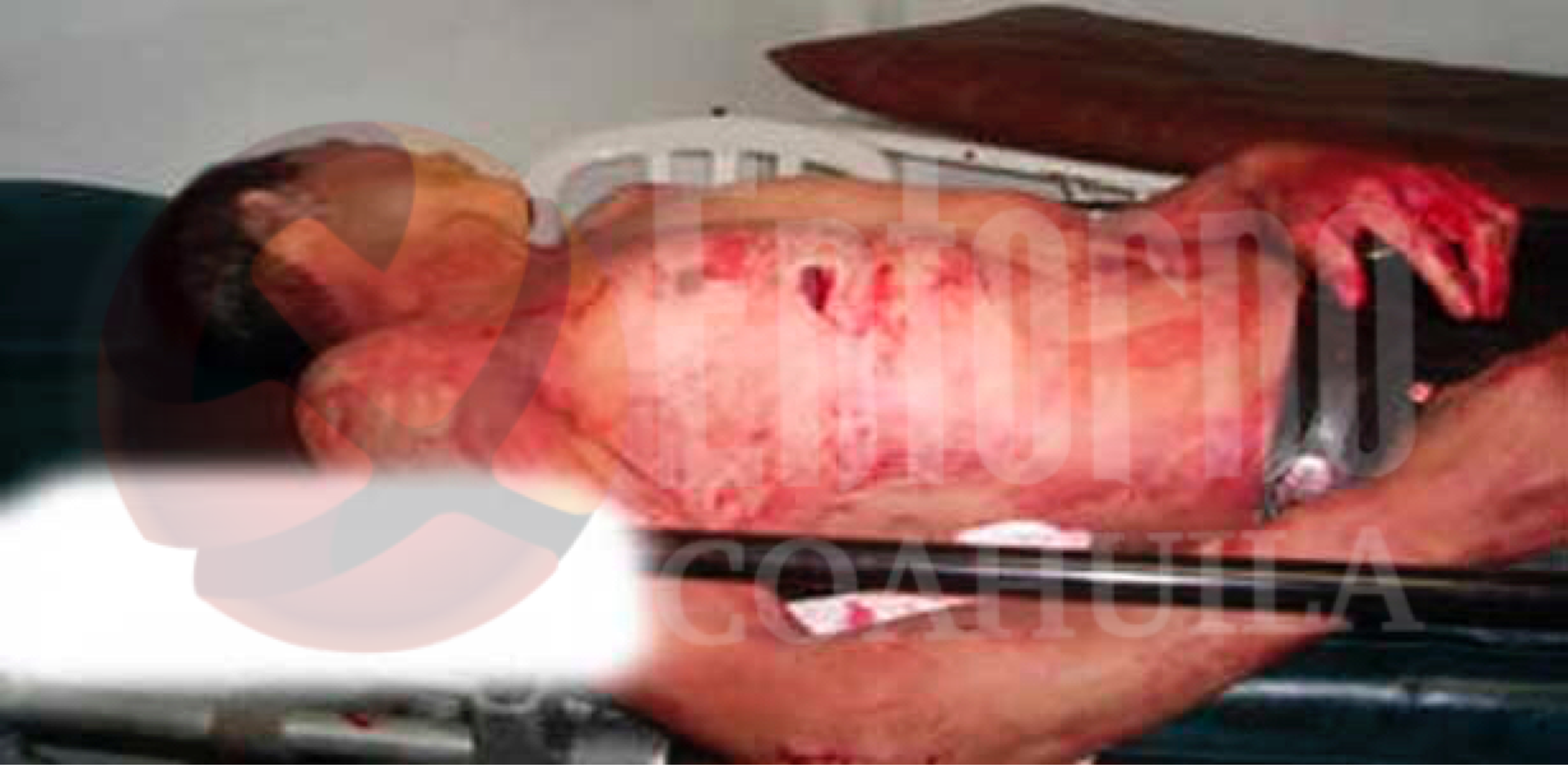 Lo apuñalan en Sabinas; está grave