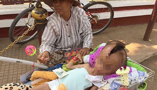 Vive con su cabeza partida en dos