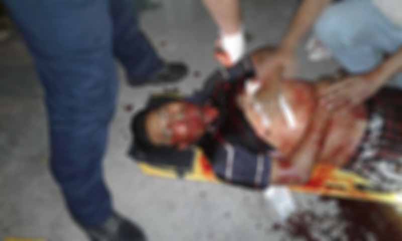 Hermanos son apuñalados en Frontera, uno muere