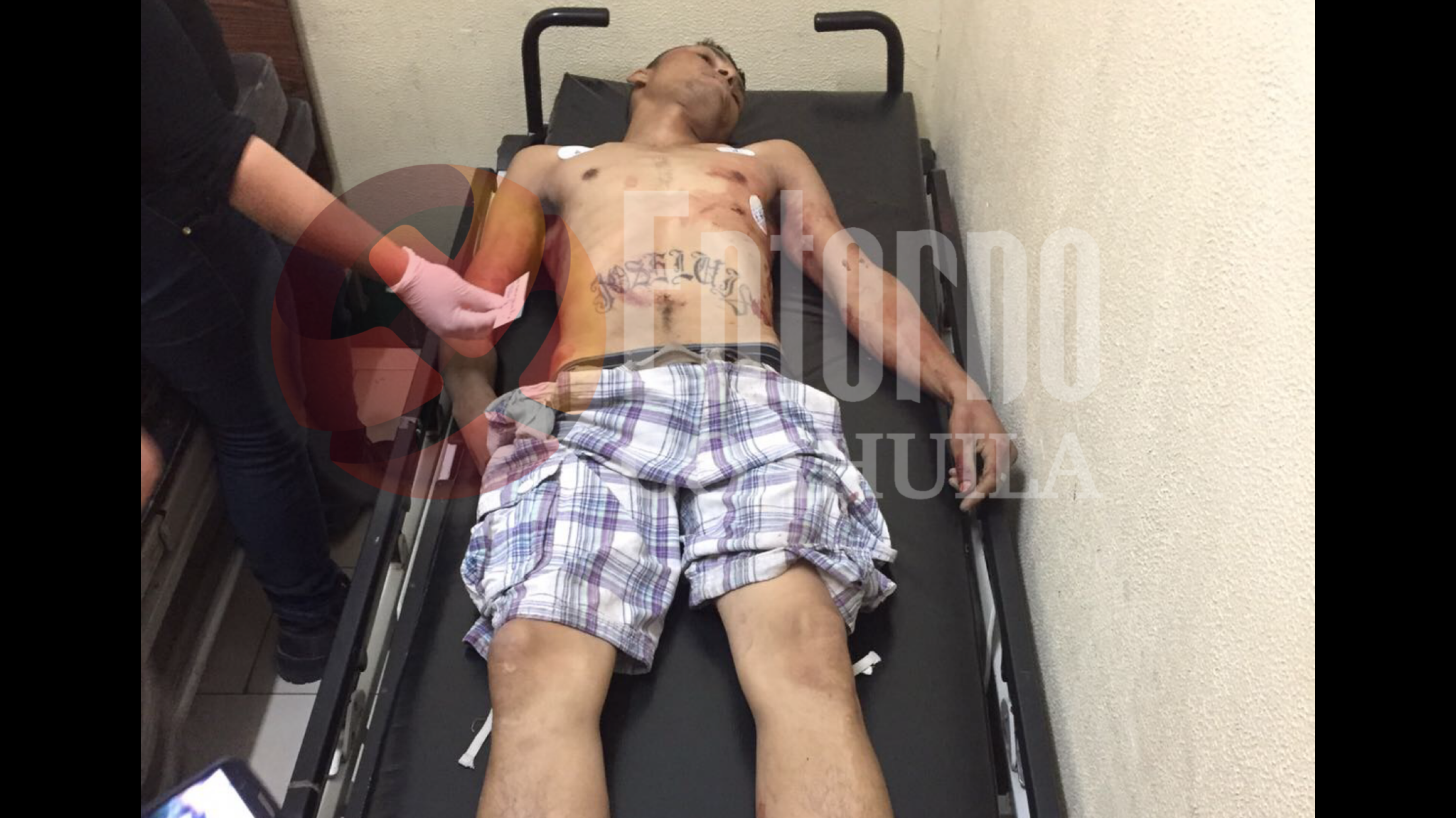 Dejan en Cruz Roja de Torreón <br>a hombre asesinado a balazos