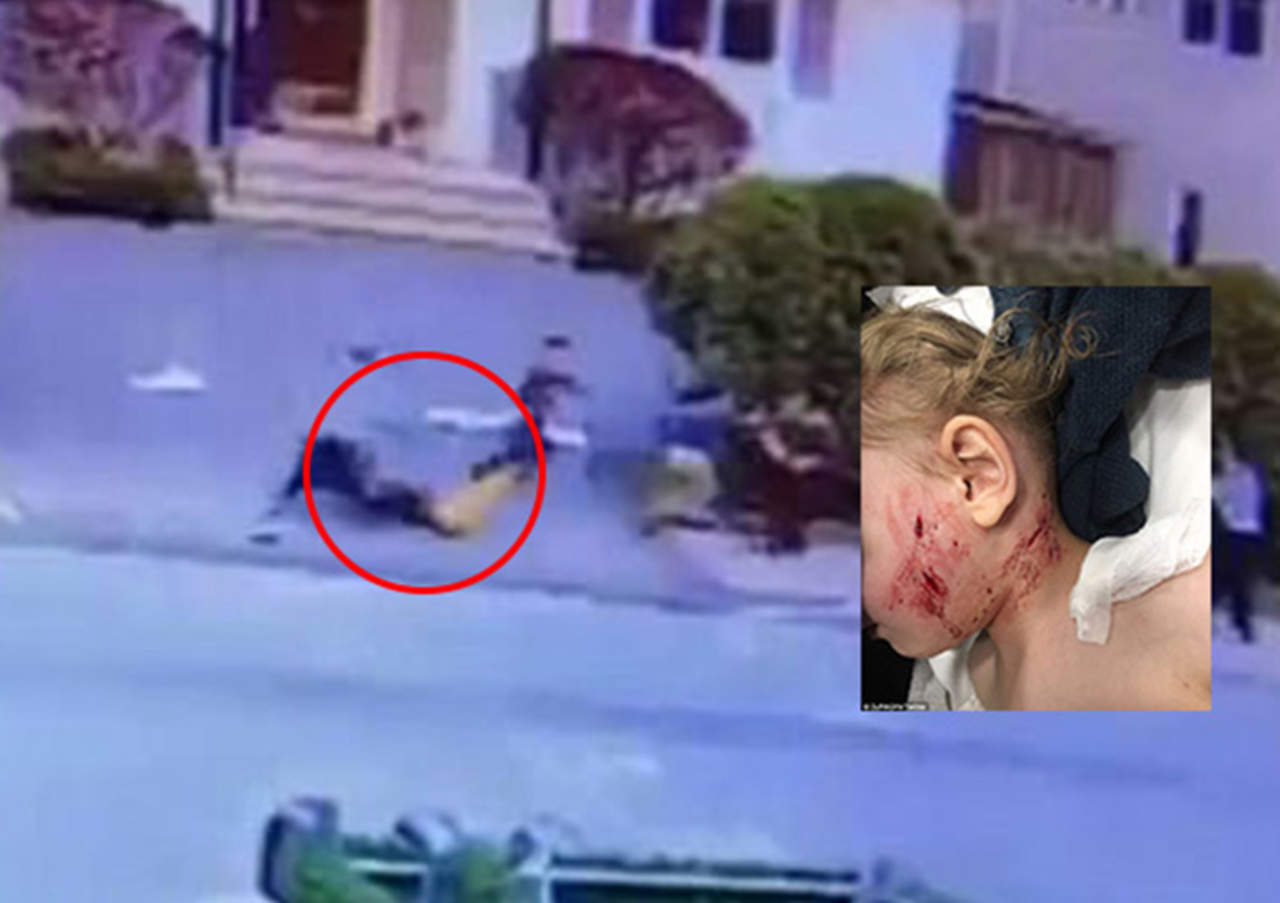 VIDEO:Pitbull ataca brutalmente a bebé de tres años