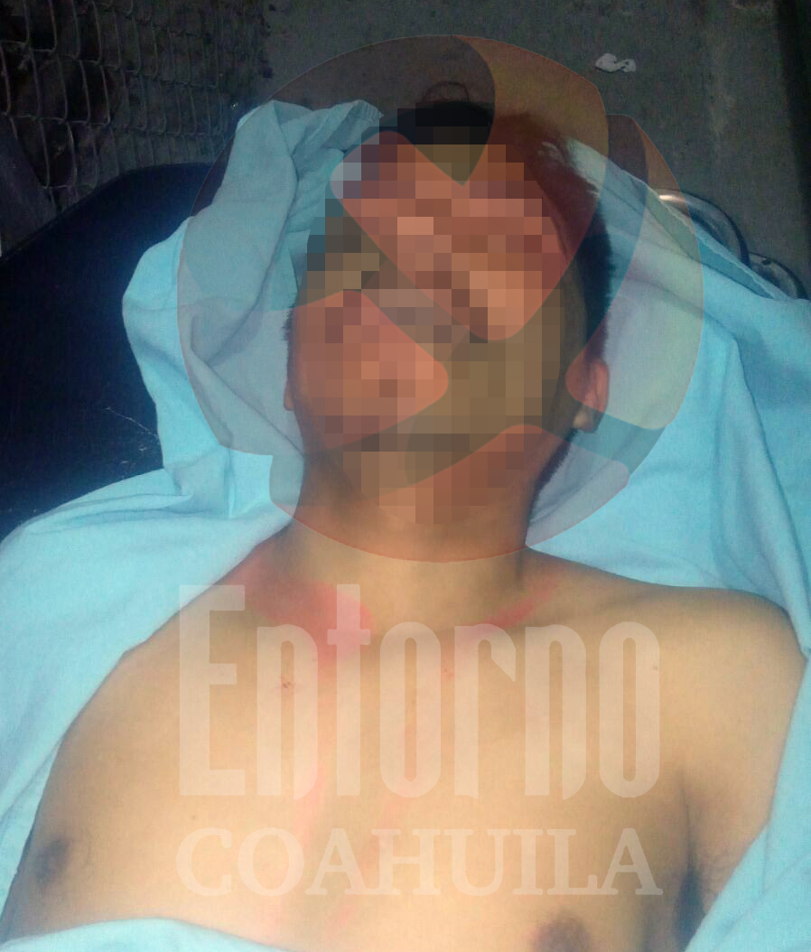 Acuñense es asesinado por su yerno a puñaladas