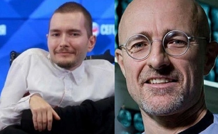 Genera polémica el primer transplante de cabeza que se realizará este año