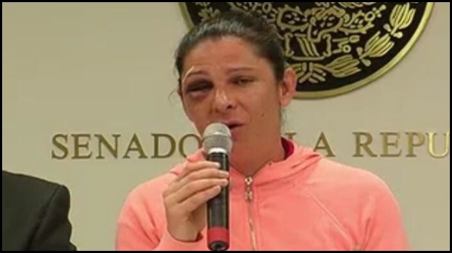 Decepciona a senadora Ana Gabriela Guevara liberación de agresor