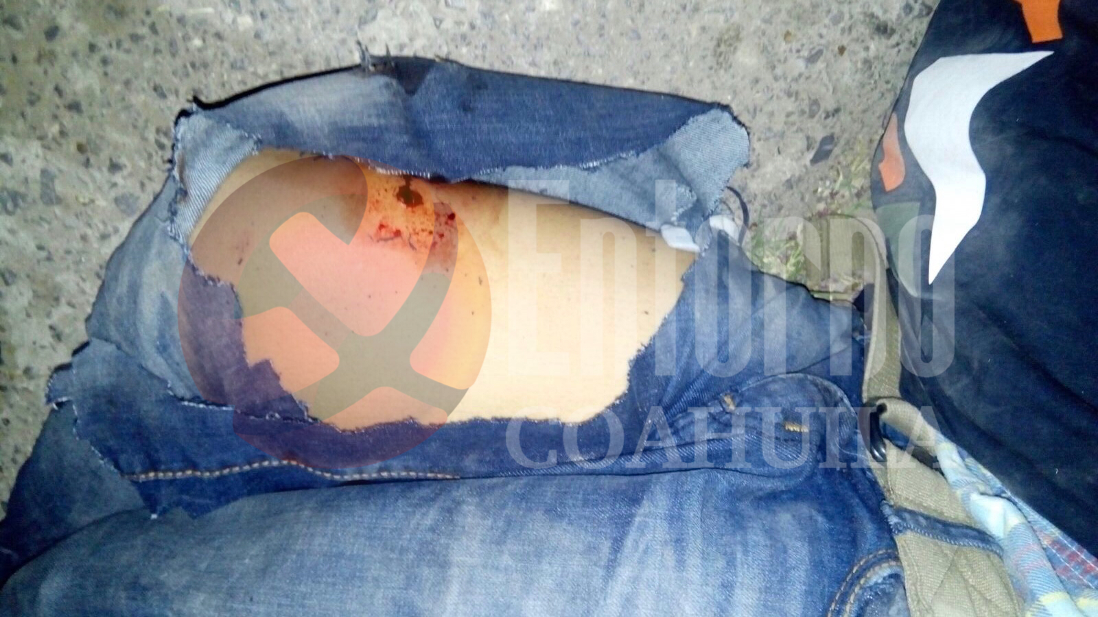 Falla ejecución contra joven en Torreón