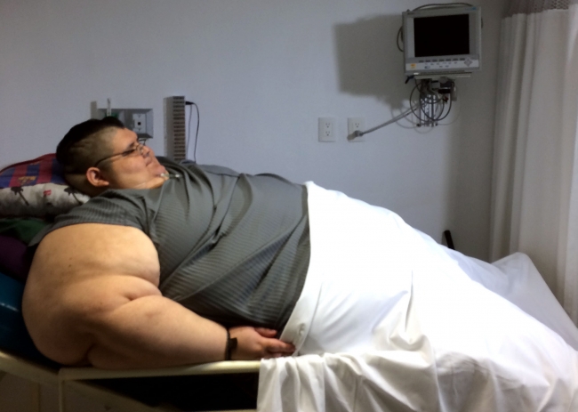 Someten a Juan Pedro, el hombre más obeso del mundo, a primera cirugía