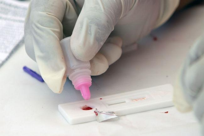 Mejora de antirretrovirales eleva esperanza de vida para pacientes con VIH