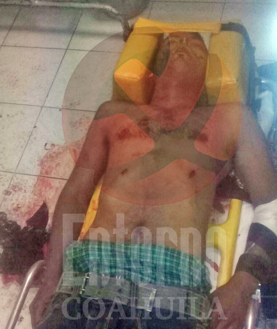 Pandilleros dejan a joven al borde de la muerte en Sabinas