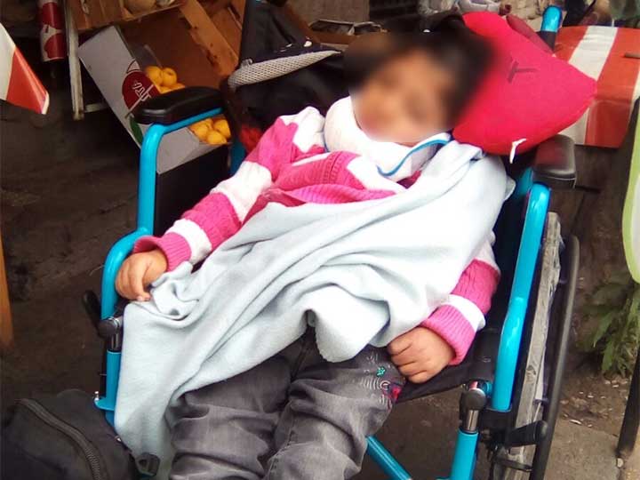 Abandonan a pequeña con discapacidad en Xochimilco