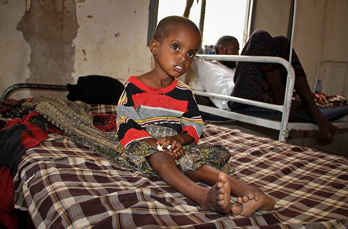 Mueren 618 personas por brote de cólera en Somalia desde enero