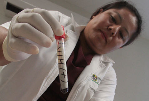 Más contagios de VIH en Coahuila